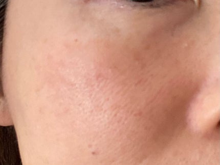 リペアジェル/リソウコーポレーション/美容液を使ったクチコミ(7枚目)