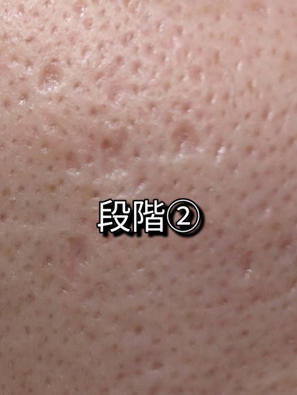 ドラマティックフェイスパウダー/マキアージュ/プレストパウダーを使ったクチコミ(4枚目)