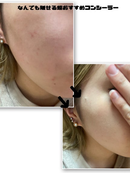 マスクフィットオールカバーデュアルコンシーラー/TIRTIR(ティルティル)/コンシーラーを使ったクチコミ(2枚目)