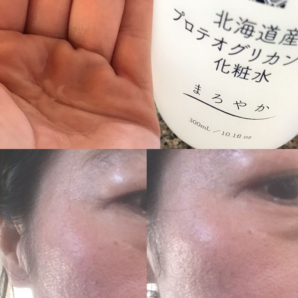 北海道産プロテオグリカン配合化粧水/北海道原液シリーズ /化粧水を使ったクチコミ（1枚目）
