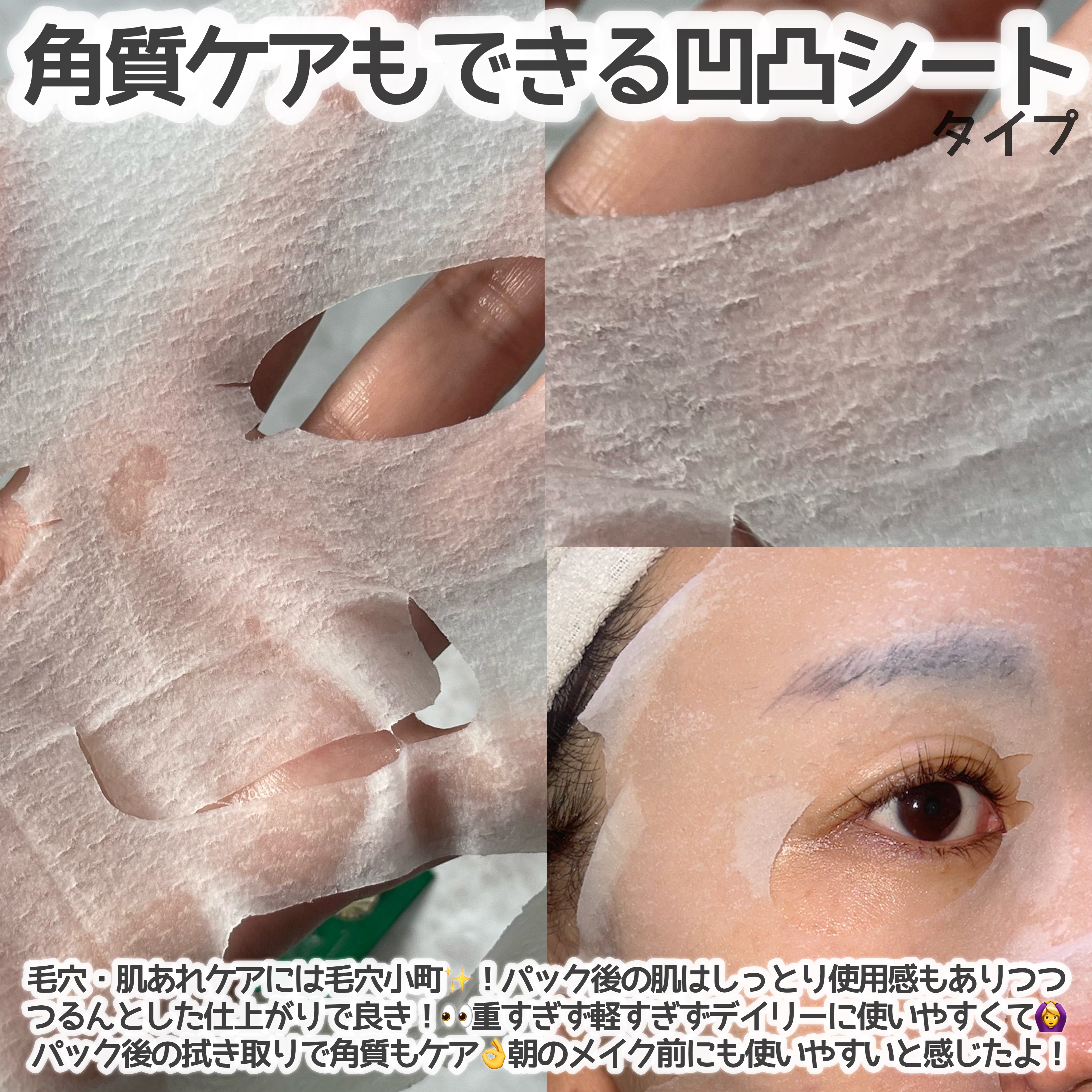 ごめんね素肌 キニナルマスク/クリアターン/シートマスク・パックを使ったクチコミ（3枚目）