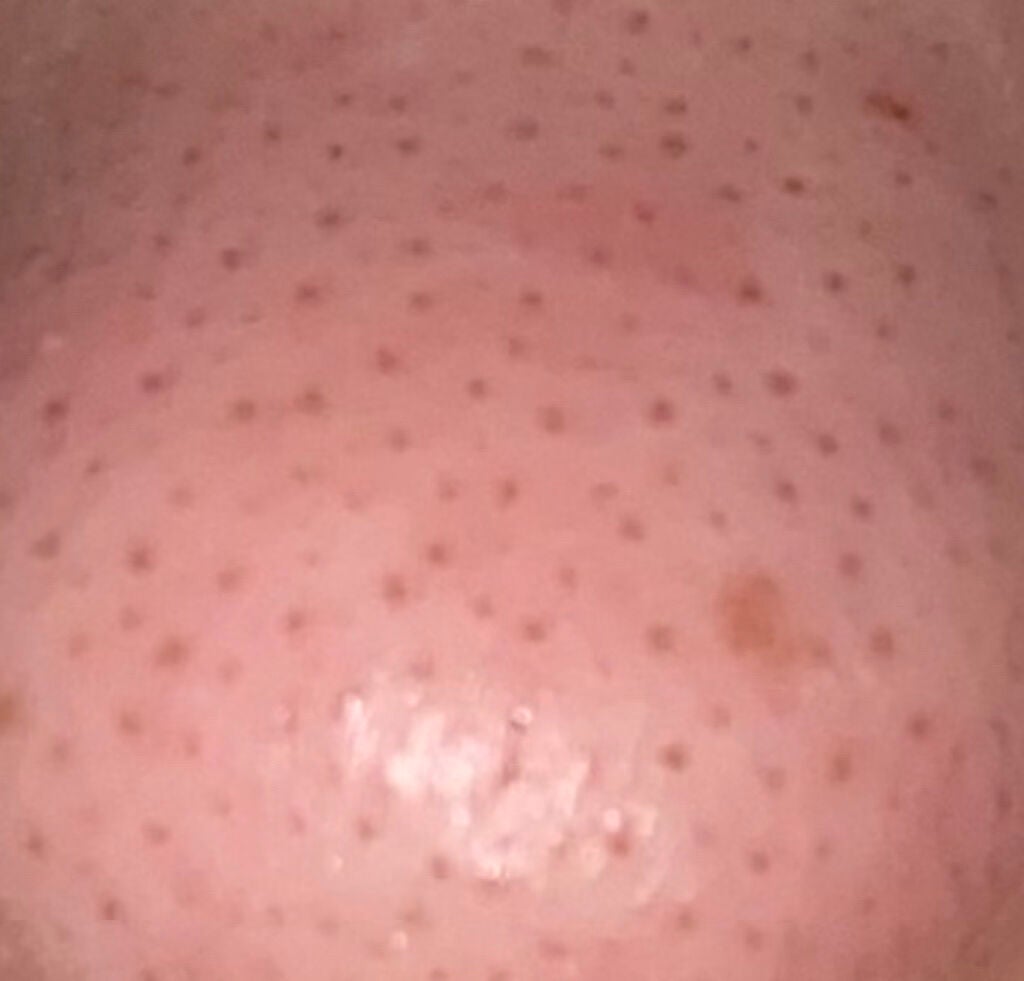 しな on LIPS 「こんにちは10代なんですけど、この肌でめちゃくちゃ悩ませていて..」(3枚目)