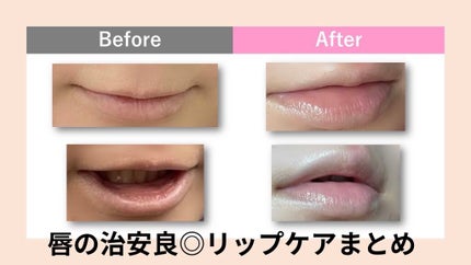 リップエッセンス/無印良品/リップケアを使ったクチコミ(1枚目)