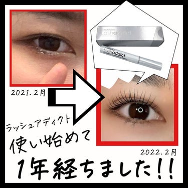 ラッシュアディクト使い始めて１年経ちました!!

正直自分自身すぐ飽き性で続けれない性格なのですが、そんな私でも１年続けられたのはちゃんと結果に出てるからです（ ;  ; ）！！

死ぬほど伸びます☆*