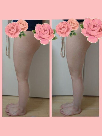 寝ながらメディキュット ロング/メディキュット/着圧ソックス・レギンスを使ったクチコミ(1枚目)