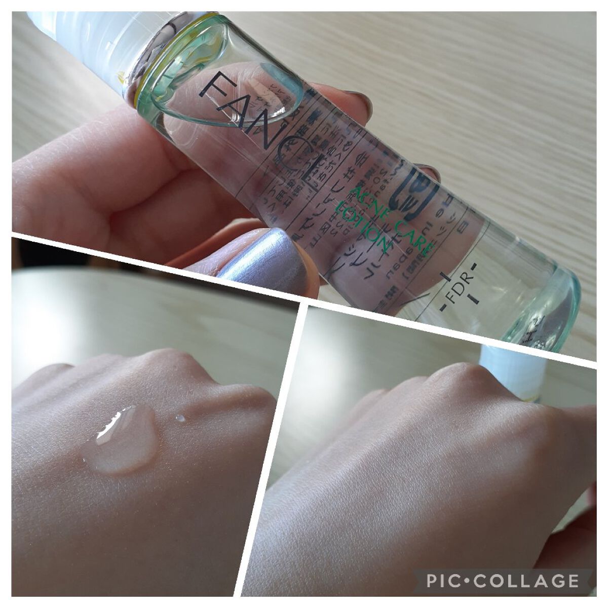 アクネケア ジェル乳液 <医薬部外品>/ファンケル/乳液を使ったクチコミ(4枚目)