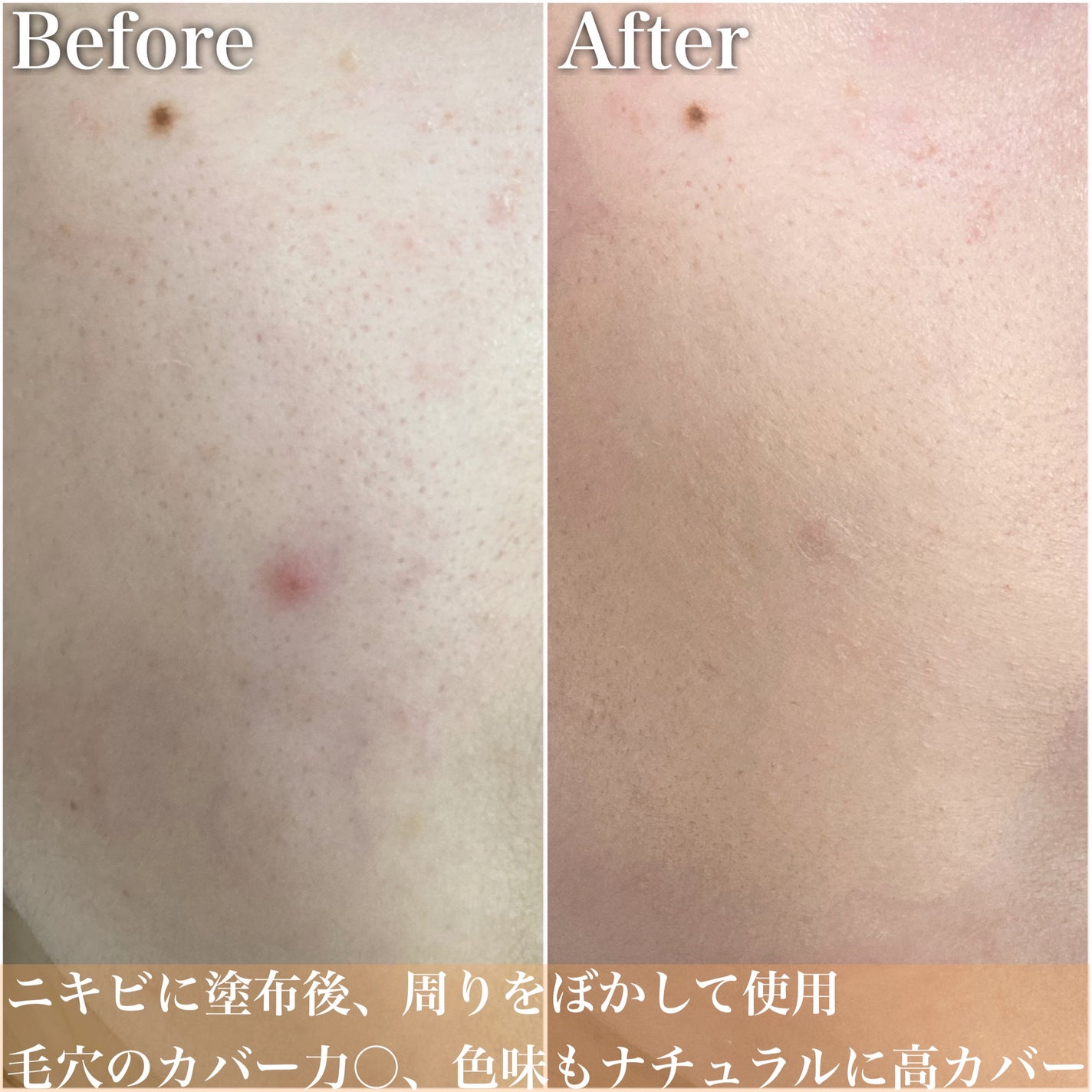 ロングラスティングチップコンシーラーフィックシングフィット/LUNA/リキッドコンシーラーを使ったクチコミ(5枚目)