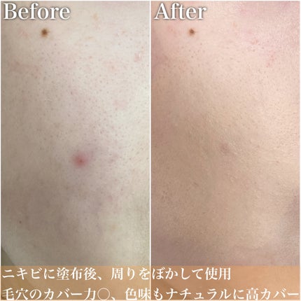 ロングラスティングチップコンシーラーフィックシングフィット/LUNA/リキッドコンシーラーを使ったクチコミ(5枚目)