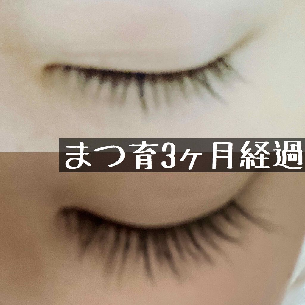 EMAKED(エマーキット)/水橋保寿堂製薬/まつげ美容液を使ったクチコミ(1枚目)