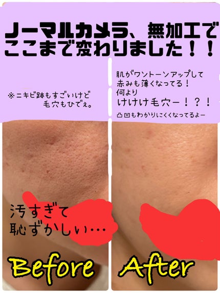 ベネフィーク ホリスティックホワイトUV/BENEFIQUE/日焼け止めスティックを使ったクチコミ(4枚目)