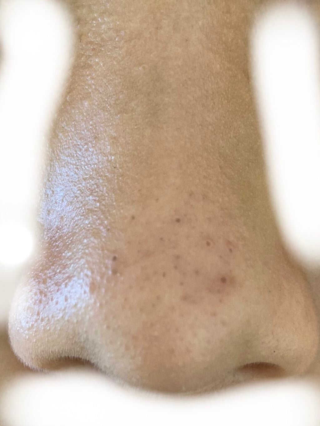 はる on LIPS 「助けてください、、、こんにちは!はるです!今回は単なる相談なん..」(1枚目)