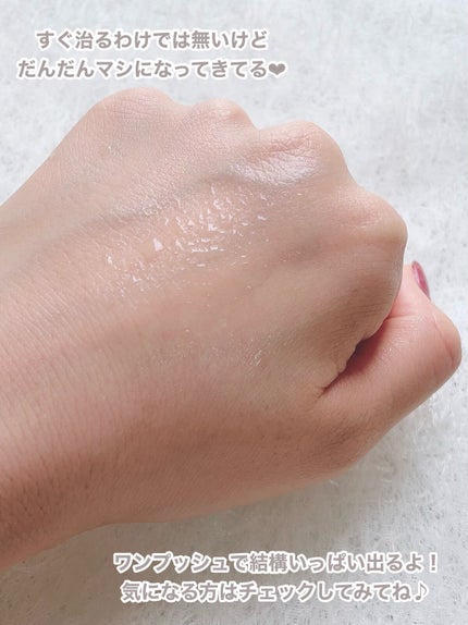 ごんす@YouTube始めました on LIPS 「《背中のブツブツにセナキュア❤︎》YouTubeの広告でよく聞..」(4枚目)