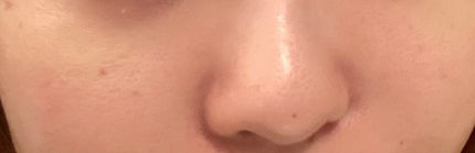 ドクダミ80%スージングアンプル/Anua/美容液を使ったクチコミ(4枚目)