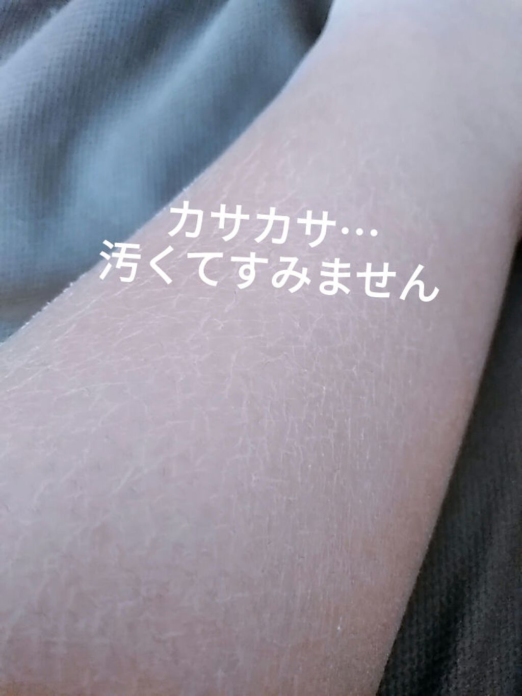 ニベアソフト スキンケアクリーム/ニベア/ボディクリームを使ったクチコミ(1枚目)