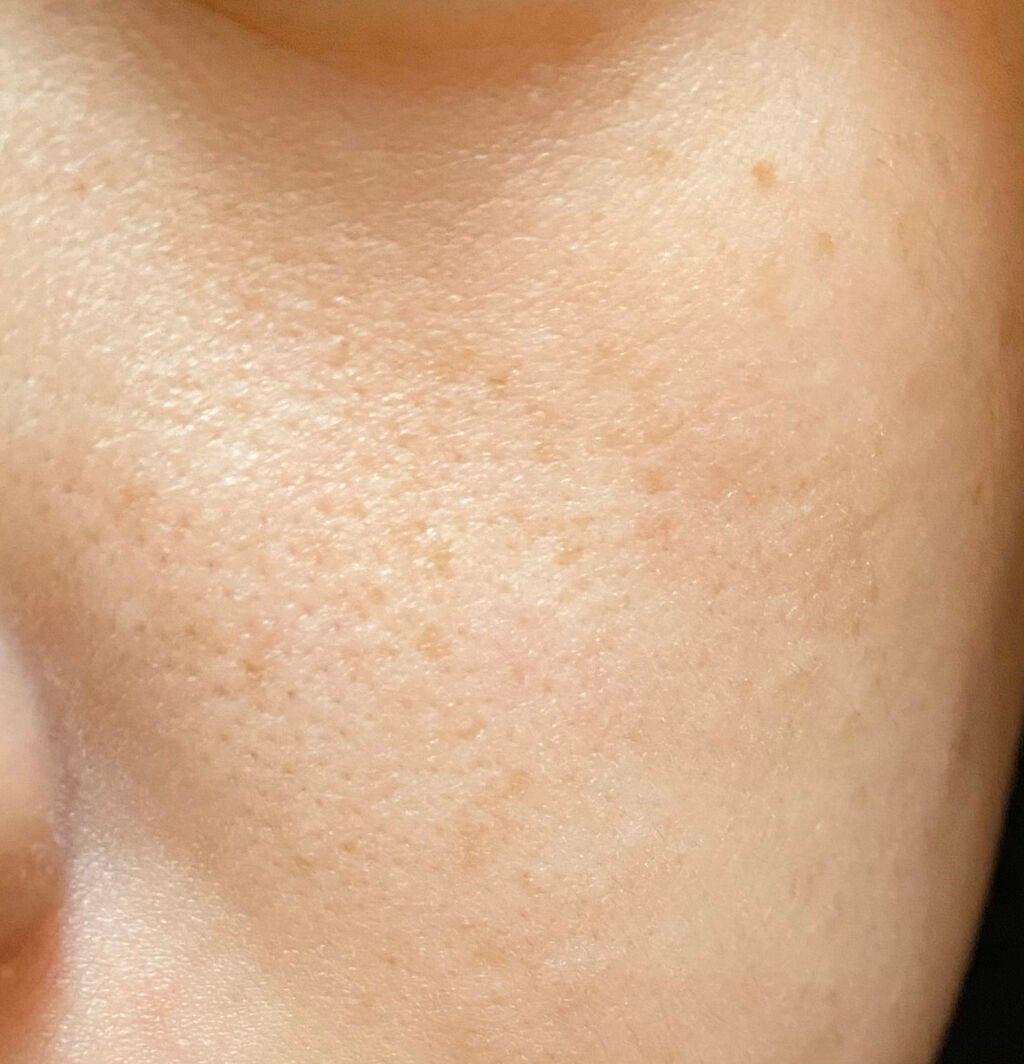 ハトムギ化粧水(ナチュリエ スキンコンディショナー R )/ナチュリエ/化粧水を使ったクチコミ(2枚目)