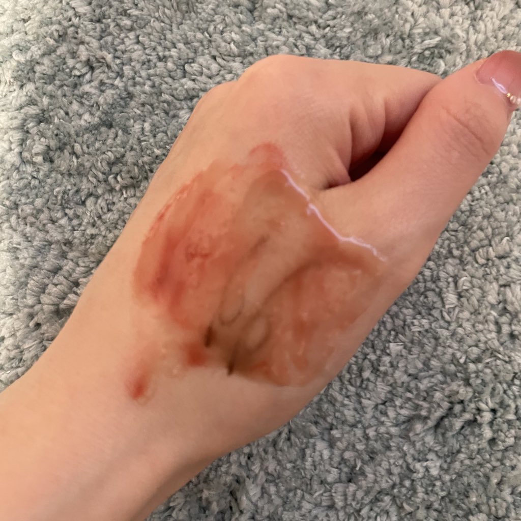 グリーンティーピュアクレンジングバームⅡ/YADAH/クレンジングバームを使ったクチコミ（3枚目）