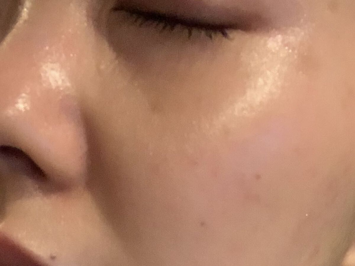 モイスチュア ローション/カルテHD/化粧水を使ったクチコミ（1枚目）