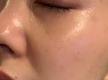 モイスチュア ローション/カルテHD/化粧水を使ったクチコミ(1枚目)