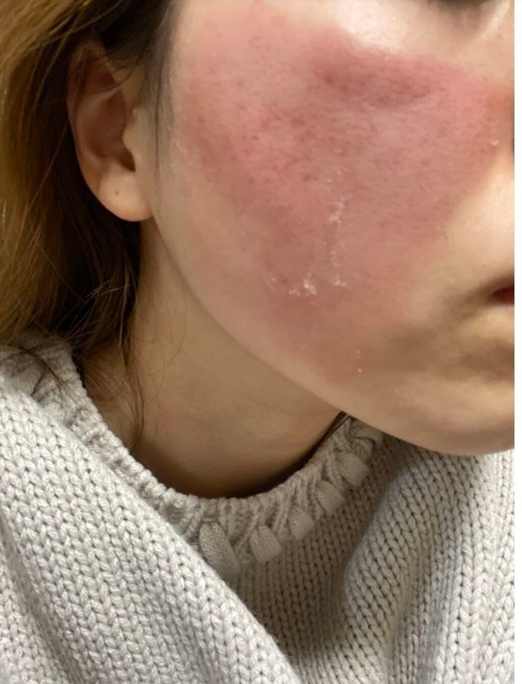 モイスチャー ミストローションII(しっとり)/アルージェ/ミスト状化粧水を使ったクチコミ(1枚目)