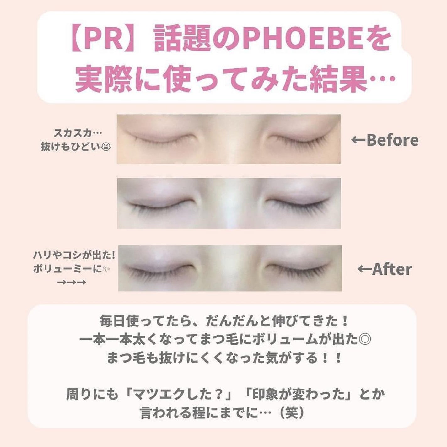 ðºð¬ðµðšðçŸå®¹ã¡ãã£ã¢ on LIPS ãã»ã(@sena_skincare.girl)ã®çŸå®¹ã»ã¹ãã³ã±..ãïŒ8æç®ïŒ