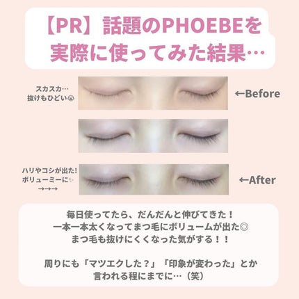 ðºð¬ðµðšðçŸå®¹ã¡ãã£ã¢ on LIPS ãã»ã(@sena_skincare.girl)ã®çŸå®¹ã»ã¹ãã³ã±..ãïŒ8æç®ïŒ