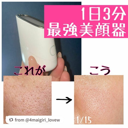 スキンライトセラピーII/Makeon/美顔器・マッサージを使ったクチコミ(1枚目)