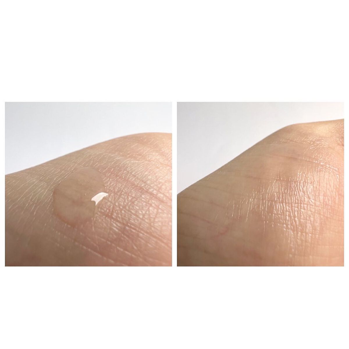 キメケア カバノアナタケバイオームアンプル/efilow/美容液を使ったクチコミ(4枚目)