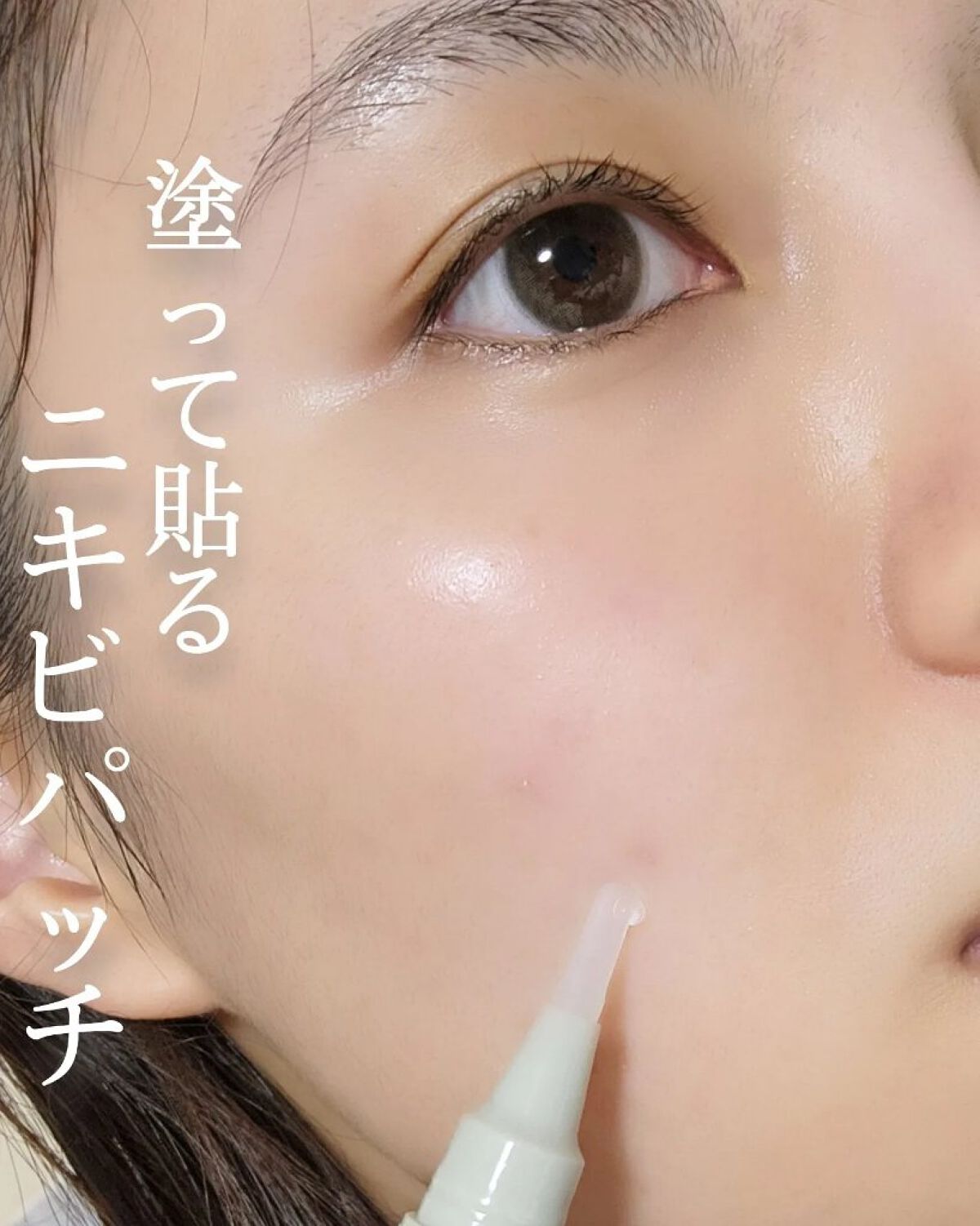 シカアロエスポットキット/FlEEF/にきびパッチを使ったクチコミ（1枚目）