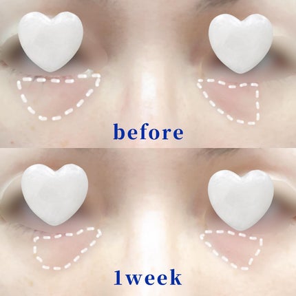 VITA K DARK CLEAR EYE CREAM/Celladix/アイケア・アイクリームを使ったクチコミ(4枚目)