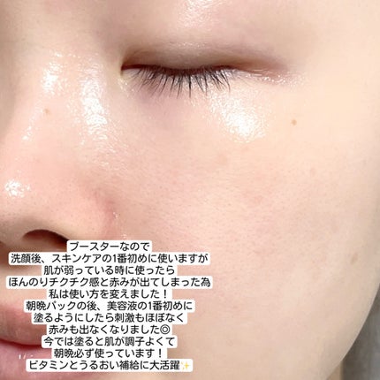 マイクロダーマブースター/XOUL/美容液を使ったクチコミ(4枚目)