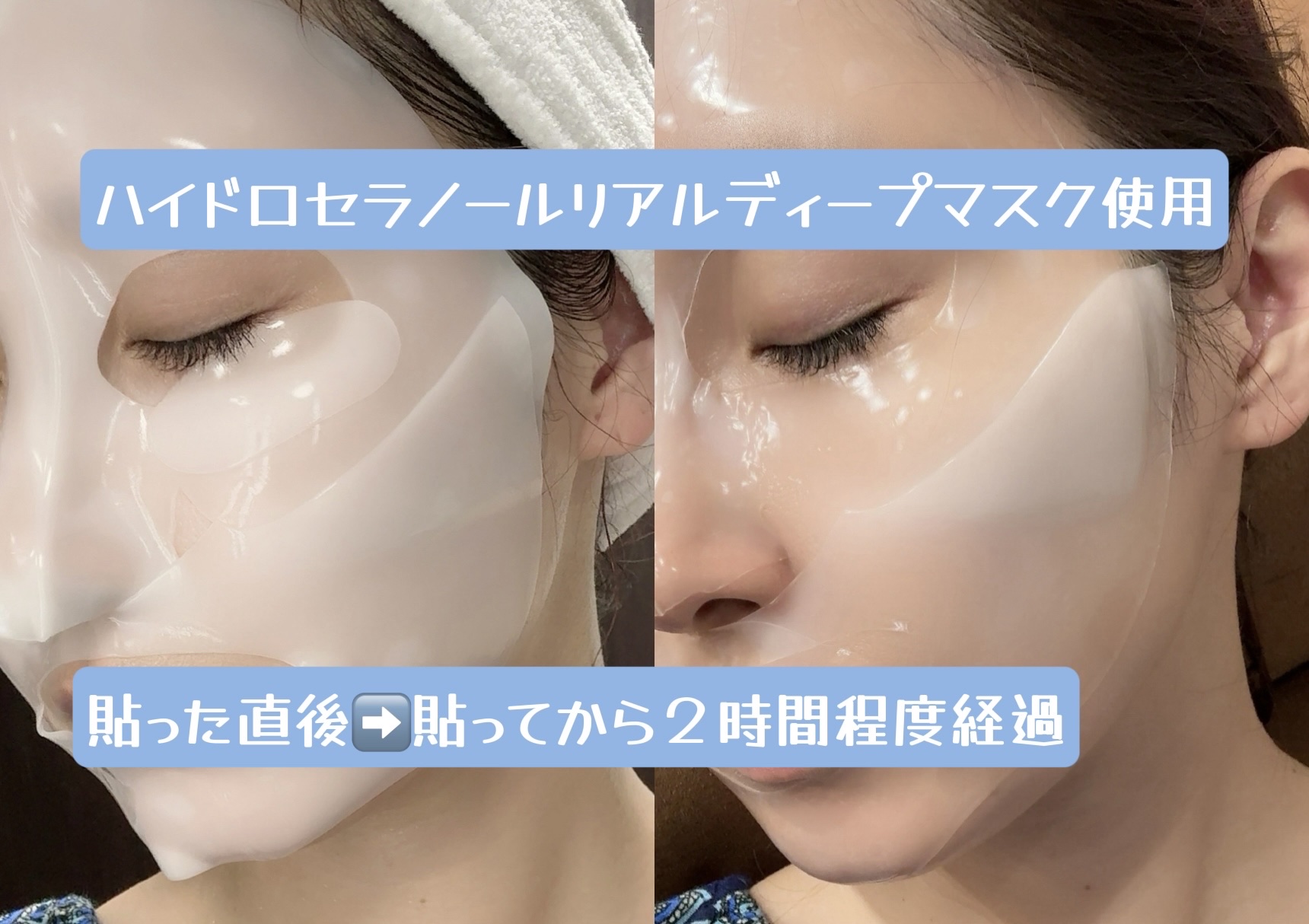 バイオコラーゲンリアルディープマスク/Biodance/シートマスク・パックを使ったクチコミ（2枚目）