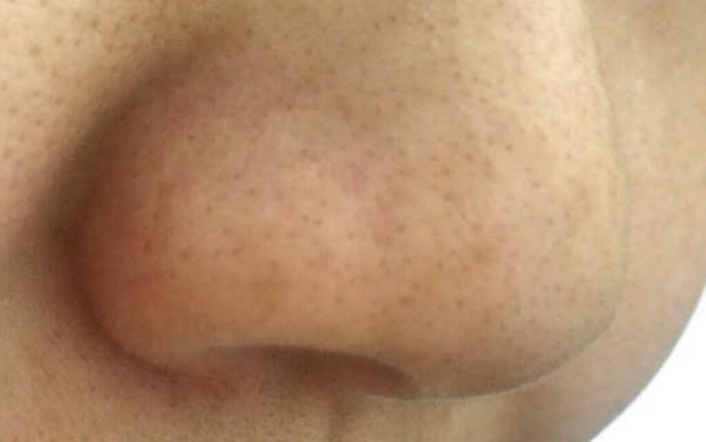 スキンアクア トーンアップUVエッセンス/スキンアクア/日焼け止めクリームを使ったクチコミ（2枚目）