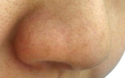 スキンアクア トーンアップUVエッセンス/スキンアクア/日焼け止めクリームを使ったクチコミ(2枚目)