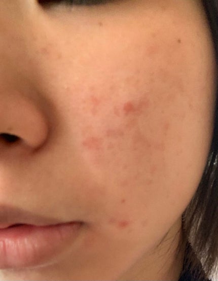 潤浸保湿 乳液/キュレル/乳液を使ったクチコミ(4枚目)