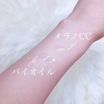 バイオイル/バイオイル/フェイスオイルを使ったクチコミ(3枚目)