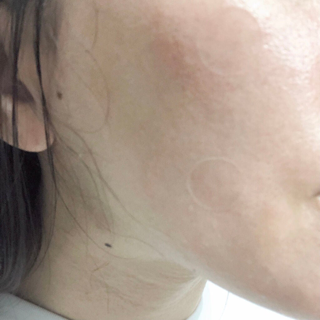 High Zyme 2step Melting Mask/Leaders Clinie(リーダーズ)/シートマスク・パックを使ったクチコミ(3枚目)