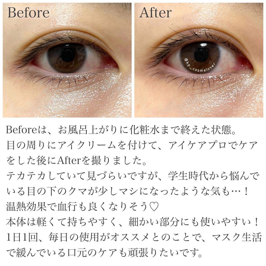 アイケアプロ/Le ment/美顔器・マッサージを使ったクチコミ(3枚目)