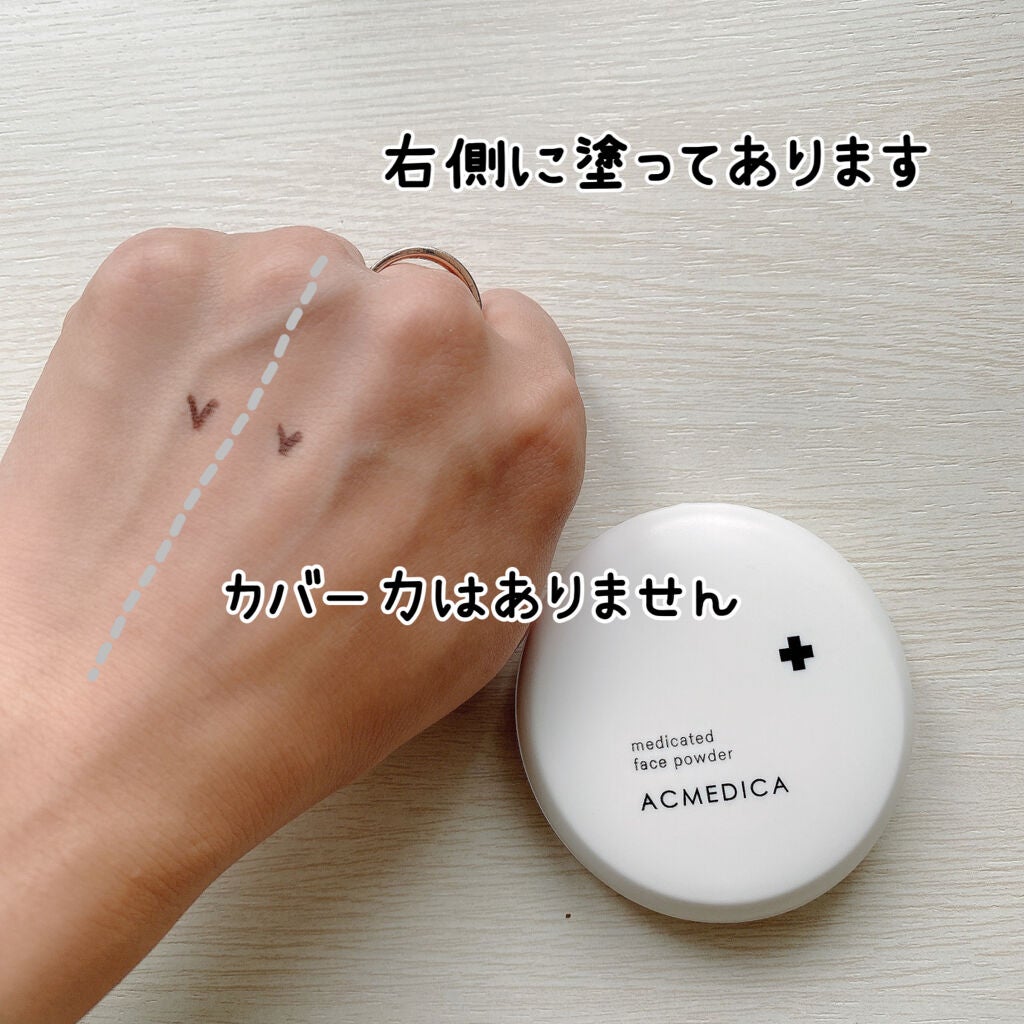 アクメディカ 薬用 フェイスパウダー クリア N/ナリスアップ/プレストパウダーを使ったクチコミ(4枚目)