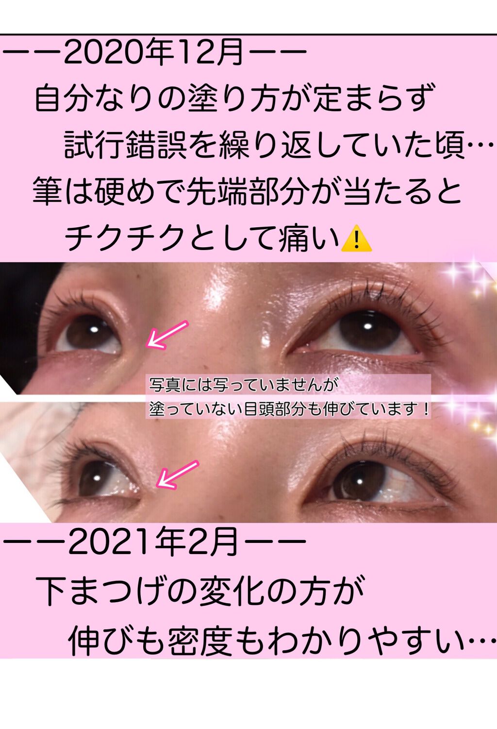 EGUTAM エグータム/アルマダスタイル/まつげ美容液を使ったクチコミ(4枚目)