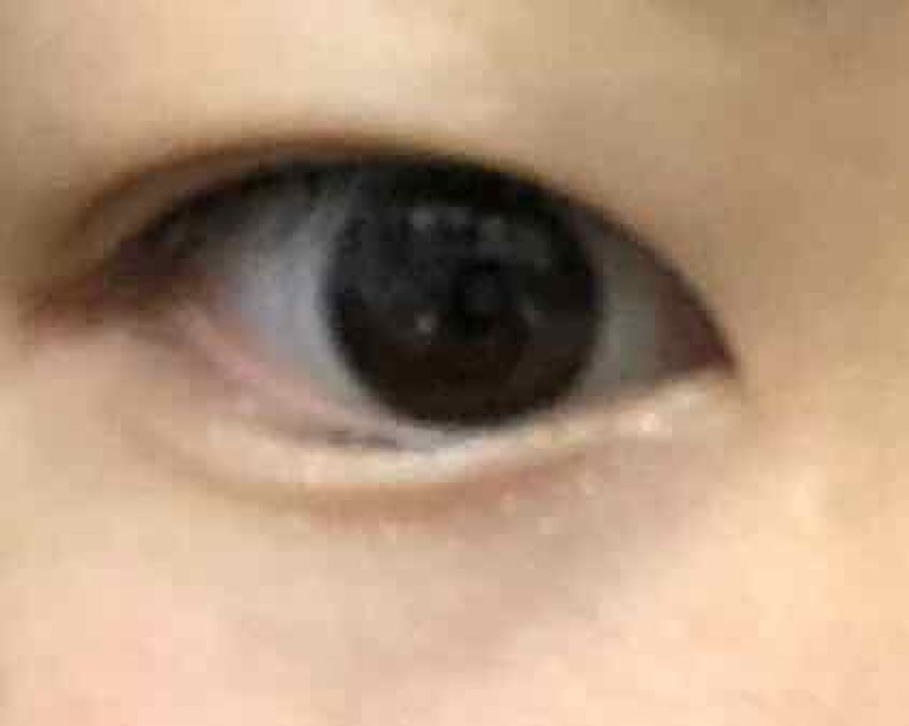 【旧品】オリシキ アイリッドスキンフィルム/D-UP/二重まぶた用アイテムを使ったクチコミ（3枚目）