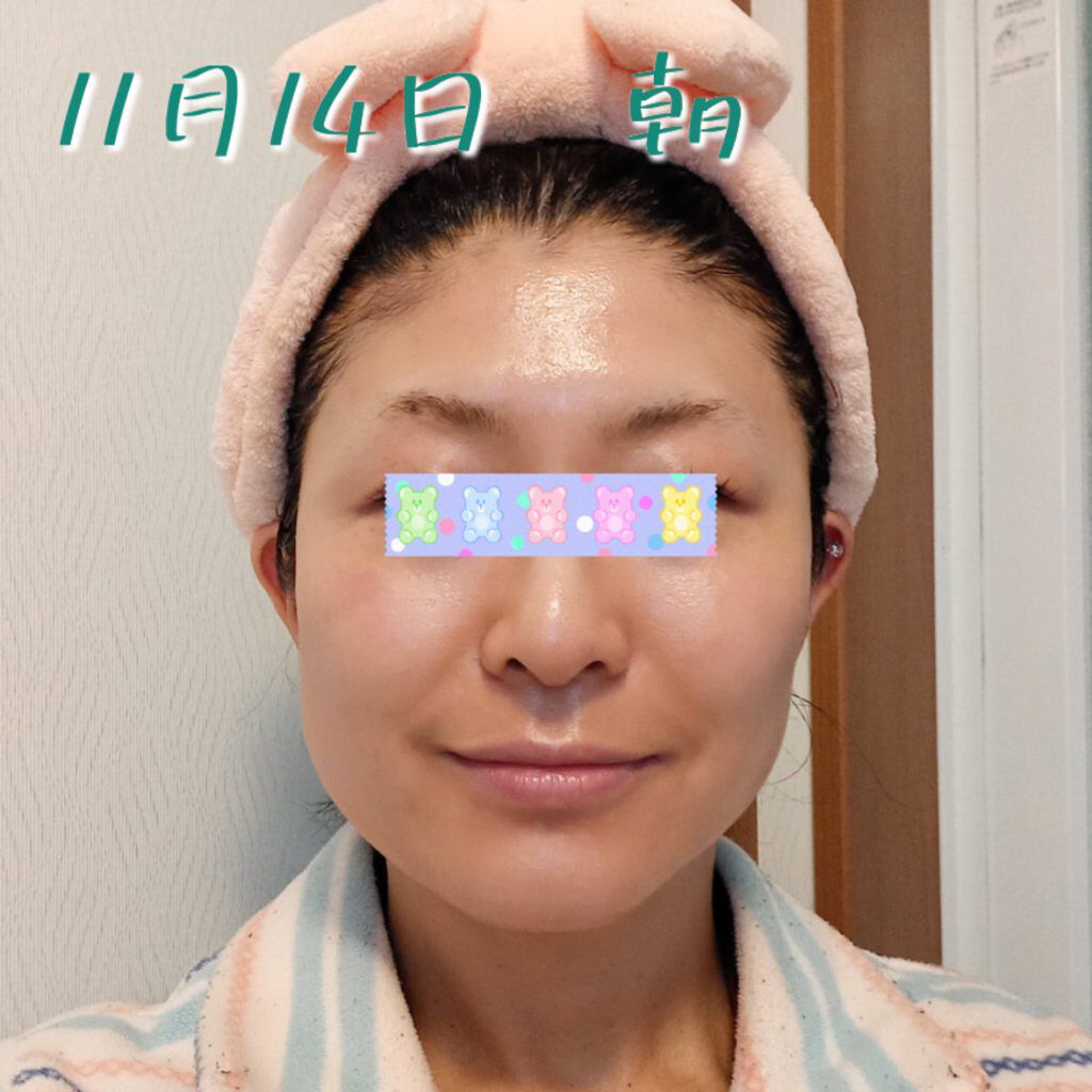 レチノールA 1% アドバンスドリバイタリゼーションクリーム/Life-flo/フェイスクリームを使ったクチコミ（1枚目）