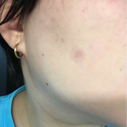 Secret solution Clear Patch/It's skin/シートマスク・パックを使ったクチコミ(4枚目)