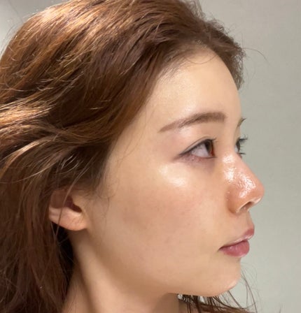 ハイドロセラノールリアルディープマスク/Biodance/シートマスク・パックを使ったクチコミ(4枚目)