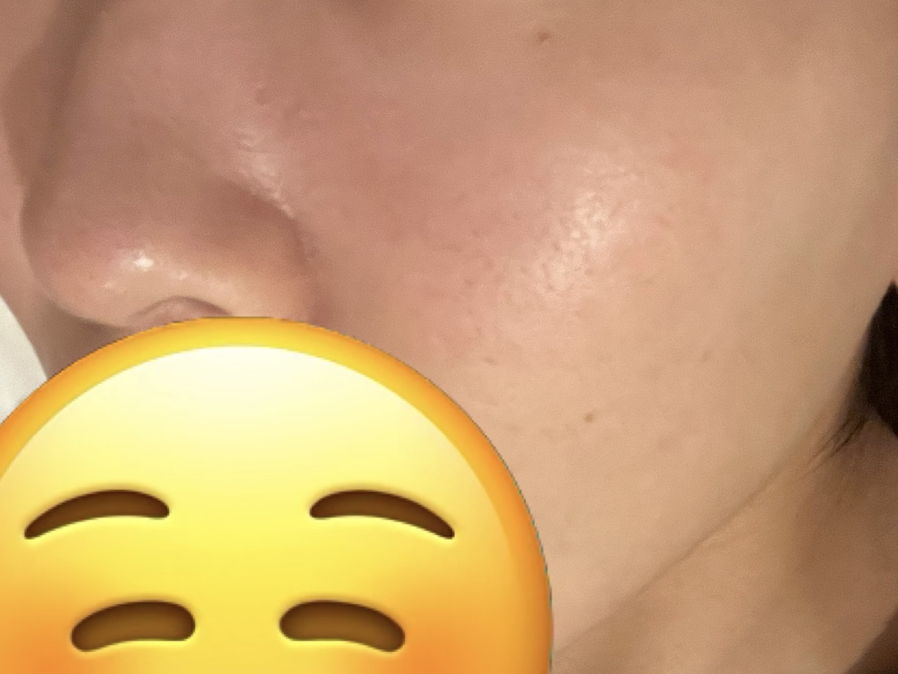 スキンピールバー ティートゥリー/サンソリット/洗顔石鹸を使ったクチコミ（1枚目）