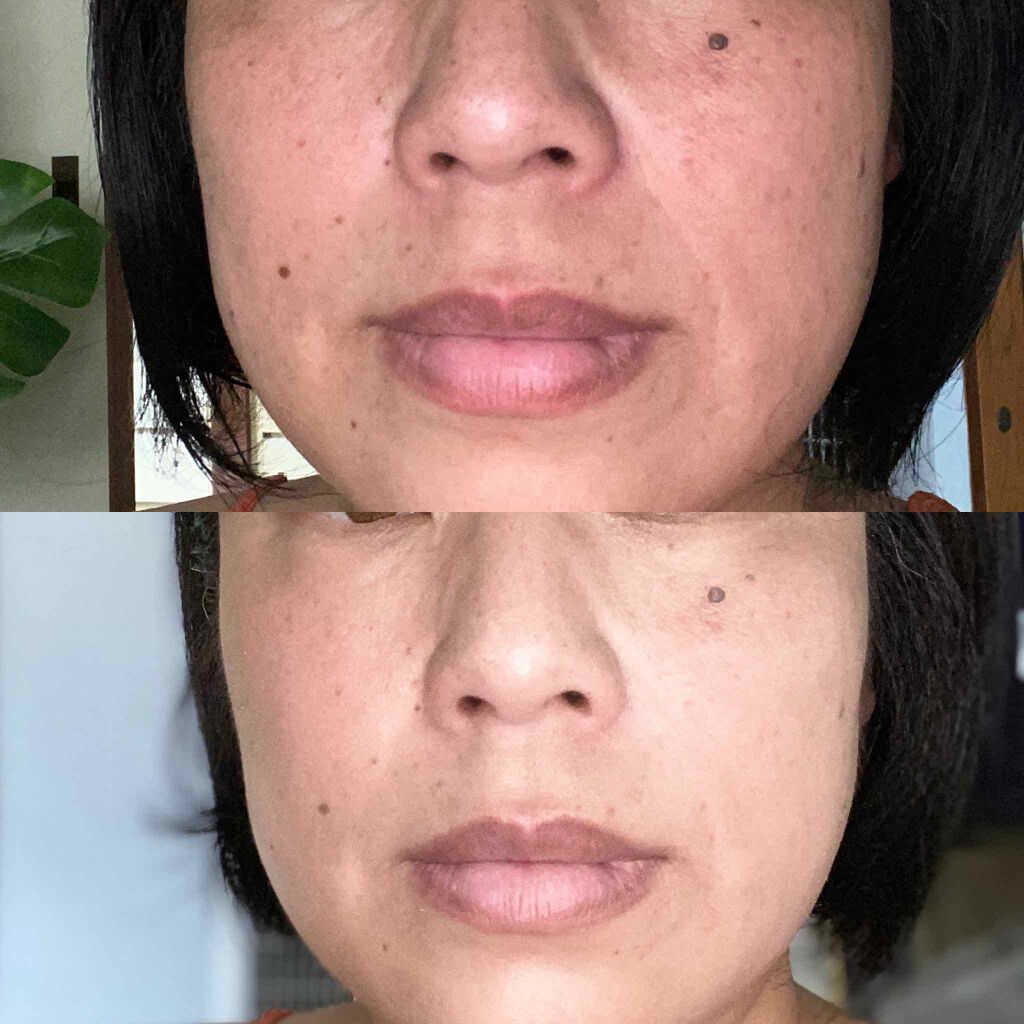 ブリリオ 15ml/CELLULA/美容液を使ったクチコミ（2枚目）