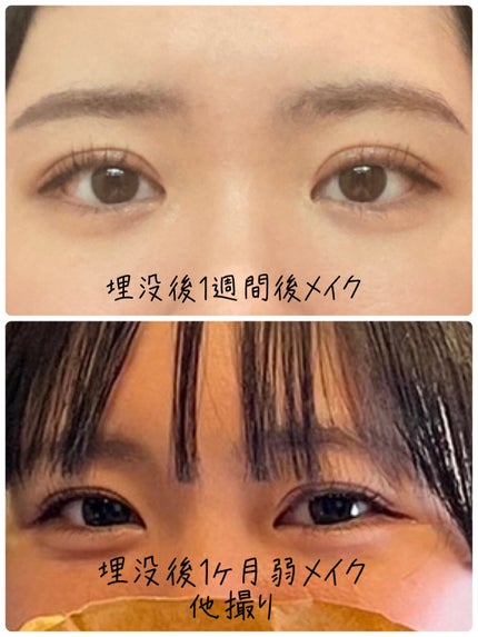 ããŸã®ãð» on LIPS ãç§ã®å没(äºéæŽåœ¢)ã«ã€ããŠðããã«ã¡ã¯ïŒãããªãã§ããç§æŽåœ¢..ãïŒ4æç®ïŒ