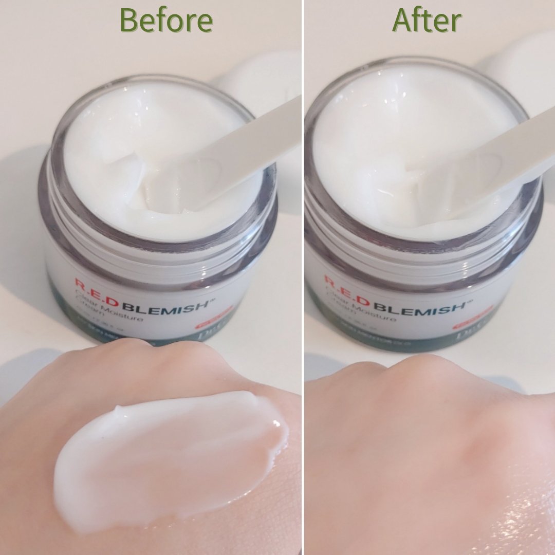 レッドブレミッシュ クリアモイスチャークリーム/Dr.G/フェイスクリームを使ったクチコミ（3枚目）