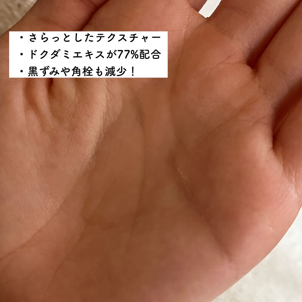 ドクダミ 77 スージングトナー/Anua/化粧水を使ったクチコミ（3枚目）