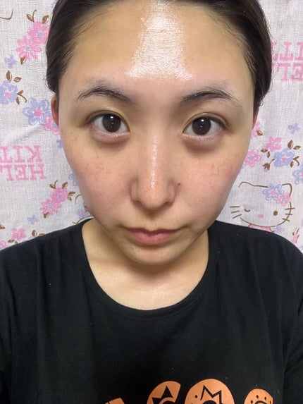 リードルショットEX ビタミンモデリングパック/VT/シートマスク・パックを使ったクチコミ(6枚目)