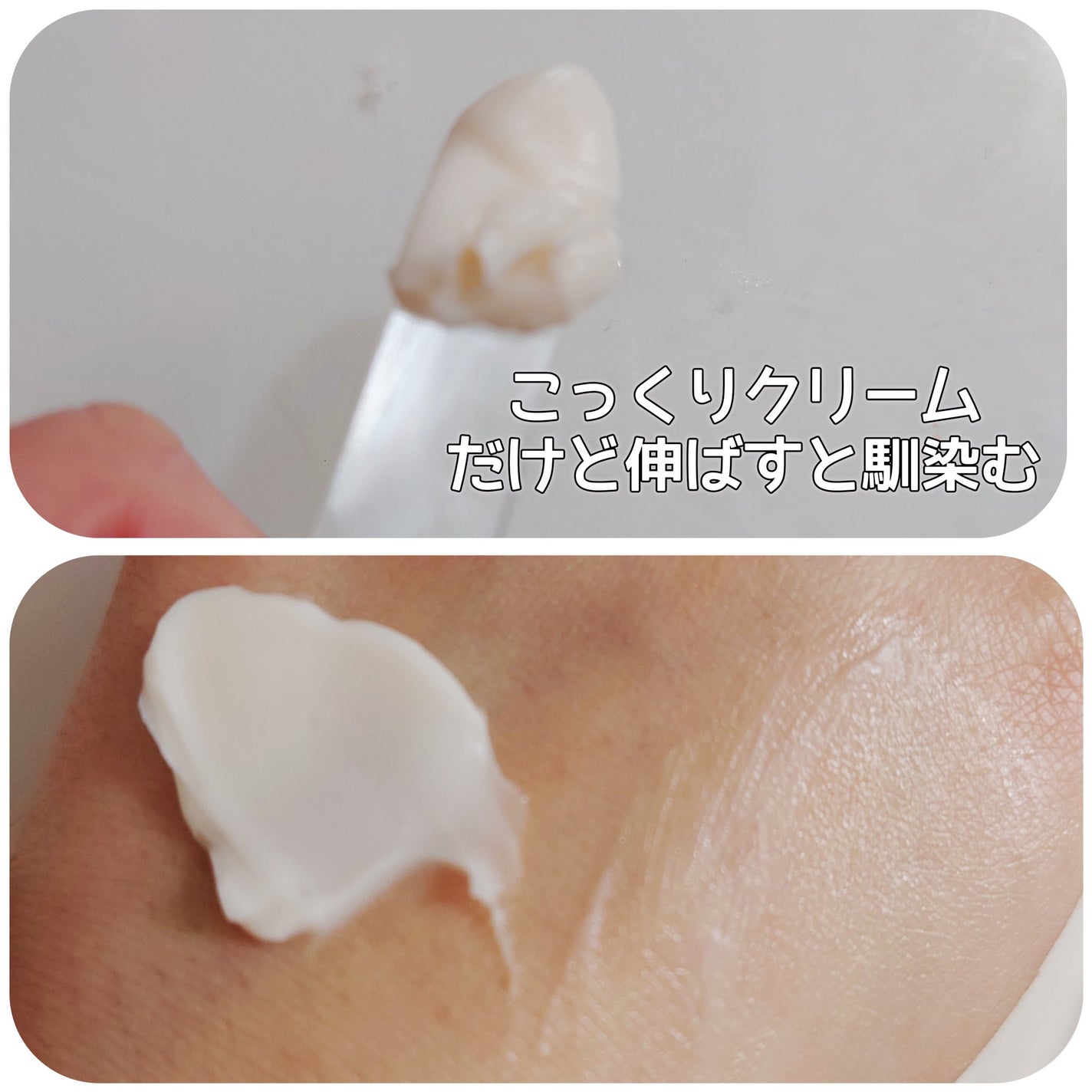 ãã€ãªããŒã«ã ãããã€ãªããŒã 3Dãªããã£ã³ã°ã¯ãªãŒã /BIOHEAL BOH/ãã§ã€ã¹ã¯ãªãŒã ã䜿ã£ãã¯ãã³ãïŒ3æç®ïŒ